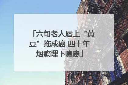 六旬老人唇上“黄豆”拖成癌 四十年烟瘾埋下隐患